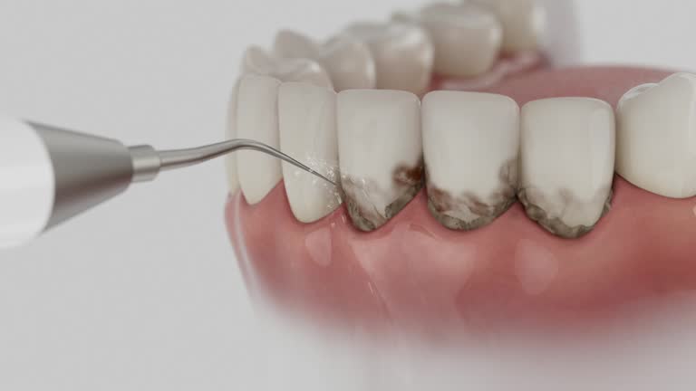 Trusted Root Canal Treatment service in Palm Shores, FL - Dentist Open Now